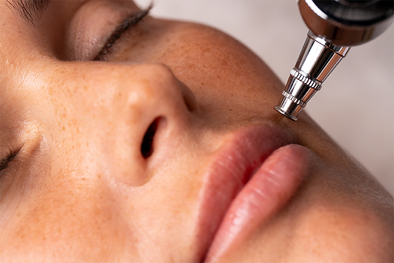 The Role of Oxygen in Advanced Skincare 