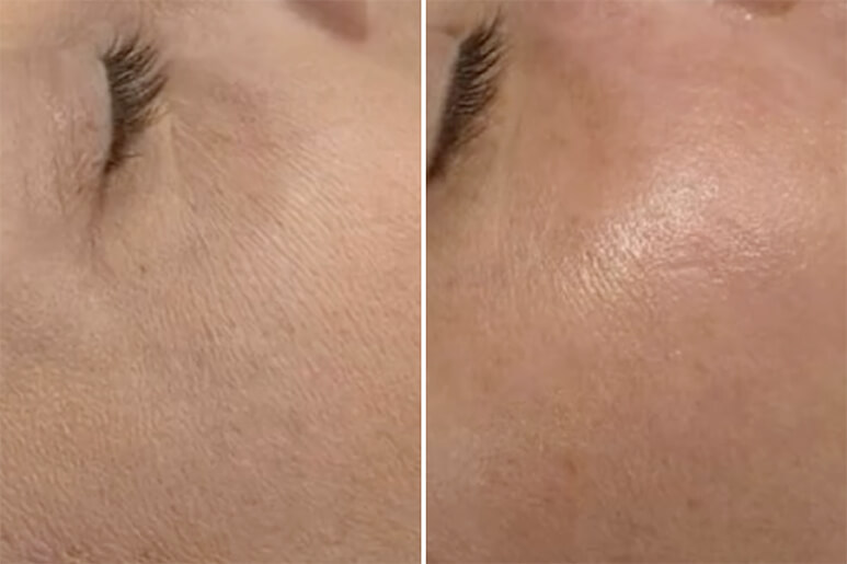 The Treatment That Reset Everything