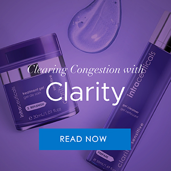 Clearing Congestion with Clarity