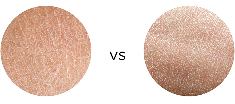 The Difference Between Dry & Dehydrated Skin